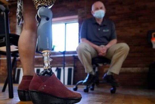 Woman plans to help fellow Rwandan amputees get prosthetics